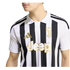 A person wearing a black and white striped Juventus home jersey with gold-toned logos and a white polo collar.